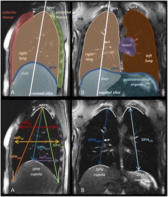 Differences of respiratory kinematics in female and male singers – A comparative study using dynamic magnetic resonance imaging